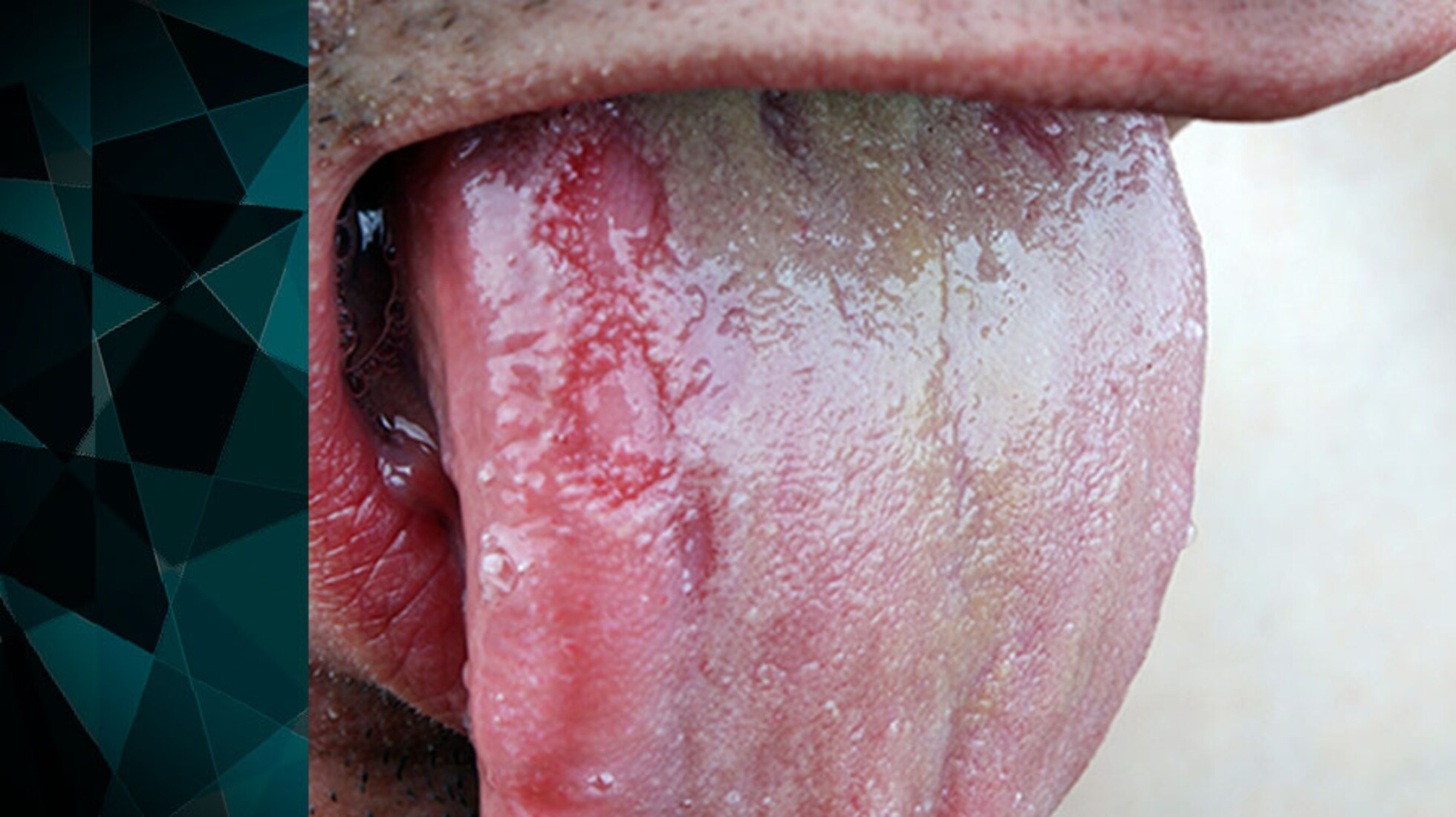 Men adult thrush mouth girlfriend